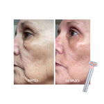 Varita Facial 4 en 1 Rejuvenecedora - Thumbnail 3